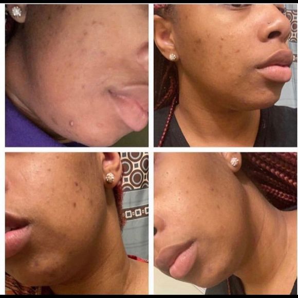 Turmeric brithtening soap vitamin c soap alpha arbutin skin brightening - Picture 2 of 5